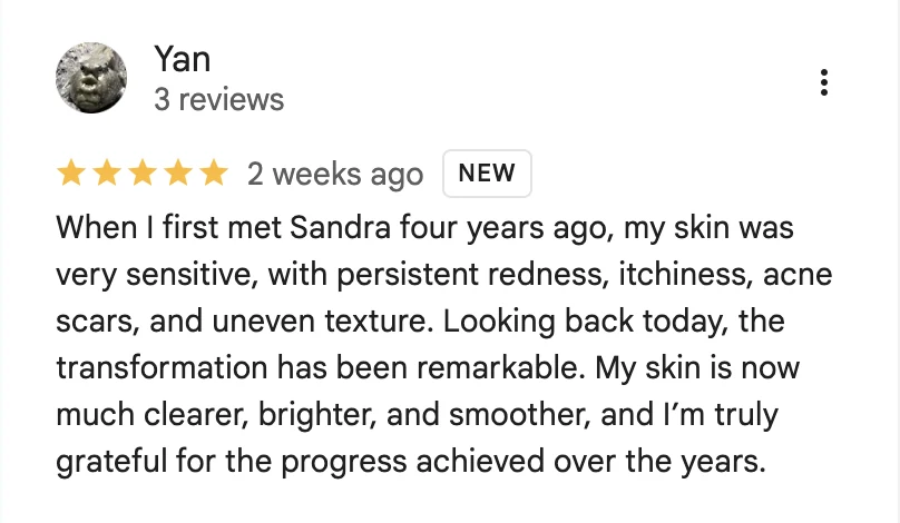 Google review describing a 4-year skin transformation from sensitive and reactive to clear and smooth